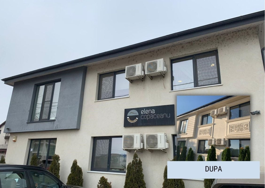 inainte dupa profile decorative